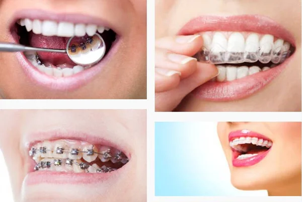 Gyan Dental Clinic