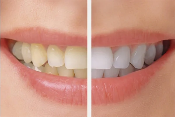 Gyan Dental Clinic
